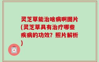 灵芝草能治啥病啊图片(灵芝草具有治疗哪些疾病的功效？照片解析)