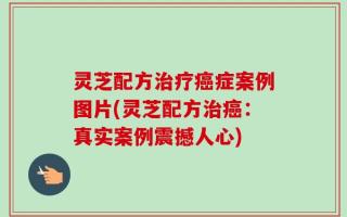 灵芝配方治疗癌症案例图片(灵芝配方治癌：真实案例震撼人心)