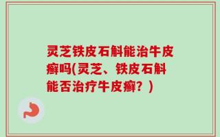 灵芝铁皮石斛能治牛皮癣吗(灵芝、铁皮石斛能否治疗牛皮癣？)