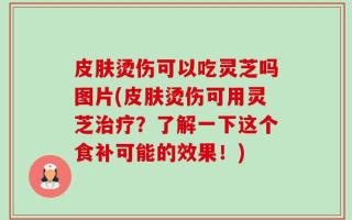 皮肤烫伤可以吃灵芝吗图片(皮肤烫伤可用灵芝治疗？了解一下这个食补可能的效果！)