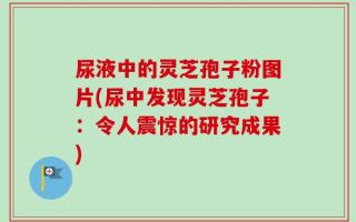 尿液中的灵芝孢子粉图片(尿中发现灵芝孢子：令人震惊的研究成果)