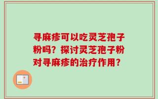 寻麻疹可以吃灵芝孢子粉吗？探讨灵芝孢子粉对寻麻疹的治疗作用？