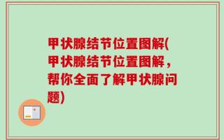 甲状腺结节位置图解(甲状腺结节位置图解，帮你全面了解甲状腺问题)
