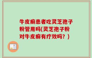 牛皮癣患者吃灵芝孢子粉管用吗(灵芝孢子粉对牛皮癣有疗效吗？)