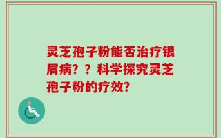 灵芝孢子粉能否治疗银屑病？？科学探究灵芝孢子粉的疗效？