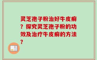 灵芝孢子粉治好牛皮癣？探究灵芝孢子粉的功效及治疗牛皮癣的方法？