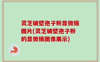 灵芝破壁孢子粉显微镜图片(灵芝破壁孢子粉的显微镜图像展示)