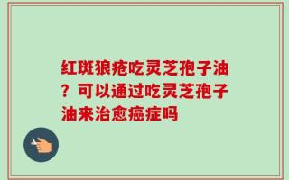 红斑狼疮吃灵芝孢子油？可以通过吃灵芝孢子油来治愈癌症吗