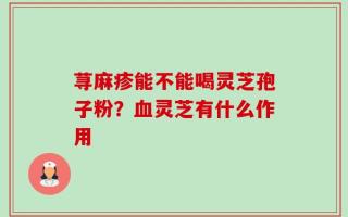 荨麻疹能不能喝灵芝孢子粉？血灵芝有什么作用
