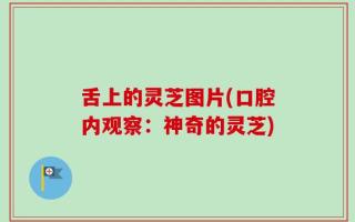 舌上的灵芝图片(口腔内观察：神奇的灵芝)