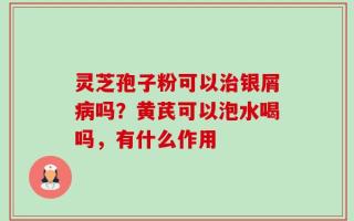 灵芝孢子粉可以治银屑病吗？黄芪可以泡水喝吗，有什么作用