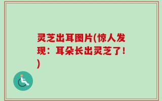 灵芝出耳图片(惊人发现：耳朵长出灵芝了！)