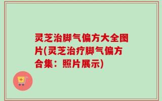 灵芝治脚气偏方大全图片(灵芝治疗脚气偏方合集：照片展示)