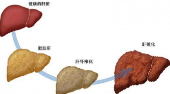 灵芝孢子粉对肝癌有治疗作用吗？灵芝孢子粉肝癌患者吃了有什么作用?-第2张图片-卓越灵芝孢子粉