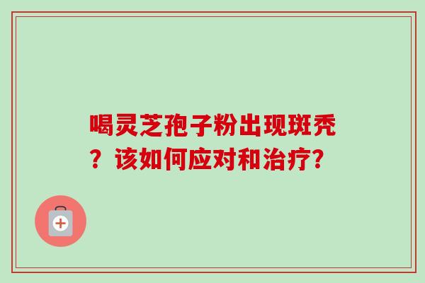 喝灵芝孢子粉出现斑秃？该如何应对和治疗？-第1张图片-卓越灵芝孢子粉