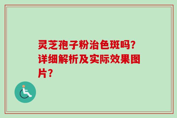 灵芝孢子粉治色斑吗？详细解析及实际效果图片？-第1张图片-卓越灵芝孢子粉