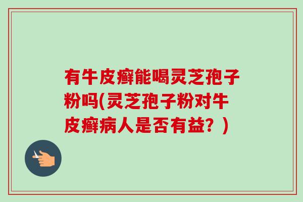 有牛皮癣能喝灵芝孢子粉吗(灵芝孢子粉对牛皮癣病人是否有益?)-第1张图片-卓越灵芝孢子粉 有牛皮癣能喝灵芝孢子粉吗(灵芝孢子粉对牛皮癣病人是否有益?)-第1张图片-卓越灵芝孢子粉