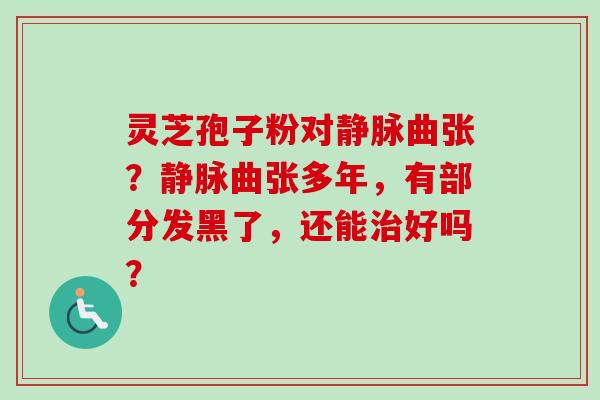 灵芝孢子粉对静脉曲张?静脉曲张多年,有部分发黑了,还能治好吗?-第1张图片-卓越灵芝孢子粉 灵芝孢子粉对静脉曲张?静脉曲张多年,有部分发黑了,还能治好吗?-第1张图片-卓越灵芝孢子粉