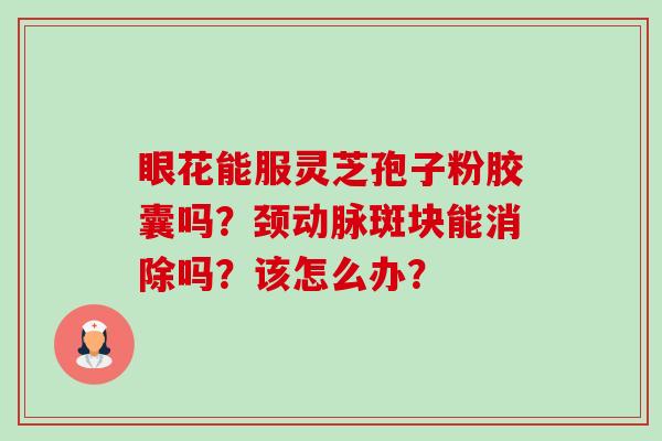 眼花能服灵芝孢子粉胶囊吗?颈动脉斑块能消除吗?该怎么办?-第1张图片-卓越灵芝孢子粉 眼花能服灵芝孢子粉胶囊吗?颈动脉斑块能消除吗?该怎么办?-第1张图片-卓越灵芝孢子粉