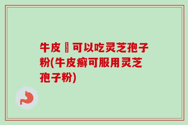 牛皮癬可以吃灵芝孢子粉(牛皮癣可服用灵芝孢子粉)-第1张图片-卓越灵芝孢子粉