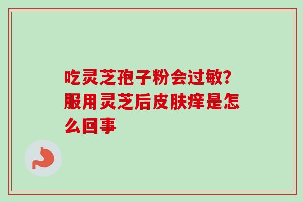 吃灵芝孢子粉会过敏?服用灵芝后皮肤痒是怎么回事-第1张图片-卓越灵芝孢子粉 吃灵芝孢子粉会过敏?服用灵芝后皮肤痒是怎么回事-第1张图片-卓越灵芝孢子粉