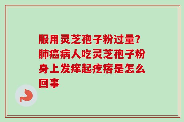 服用灵芝孢子粉过量?肺癌病人吃灵芝孢子粉身上发痒起疙瘩是怎么回事-第1张图片-卓越灵芝孢子粉 服用灵芝孢子粉过量?肺癌病人吃灵芝孢子粉身上发痒起疙瘩是怎么回事-第1张图片-卓越灵芝孢子粉