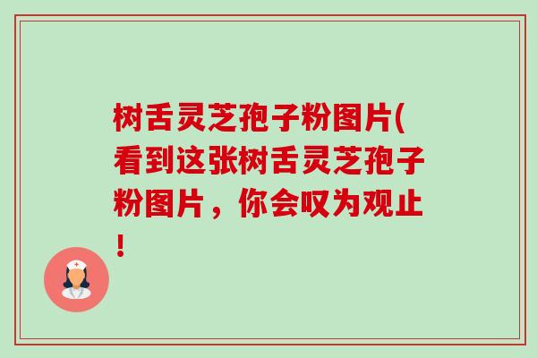 树舌灵芝孢子粉图片(看到这张树舌灵芝孢子粉图片,你会叹为观止!-第1张图片-卓越灵芝孢子粉 树舌灵芝孢子粉图片(看到这张树舌灵芝孢子粉图片,你会叹为观止!-第1张图片-卓越灵芝孢子粉