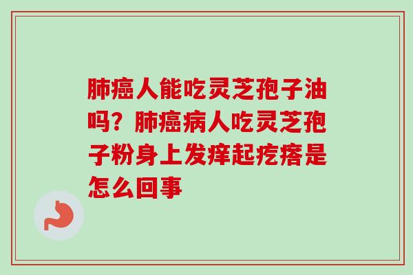 肺癌人能吃灵芝孢子油吗?肺癌病人吃灵芝孢子粉身上发痒起疙瘩是怎么回事-第1张图片-卓越灵芝孢子粉 肺癌人能吃灵芝孢子油吗?肺癌病人吃灵芝孢子粉身上发痒起疙瘩是怎么回事-第1张图片-卓越灵芝孢子粉