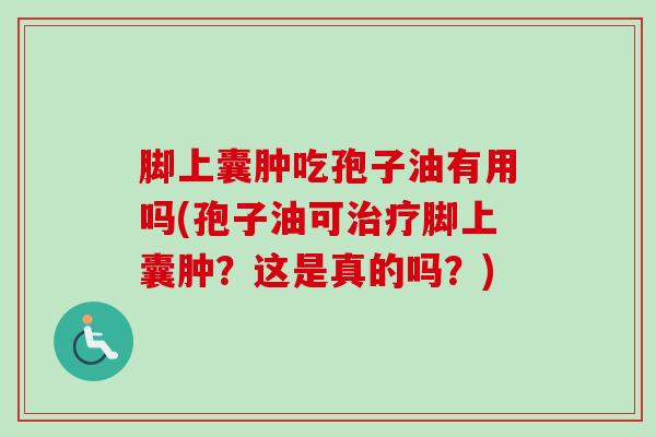 脚上囊肿吃孢子油有用吗(孢子油可治疗脚上囊肿？这是真的吗？)-第1张图片-卓越灵芝孢子粉