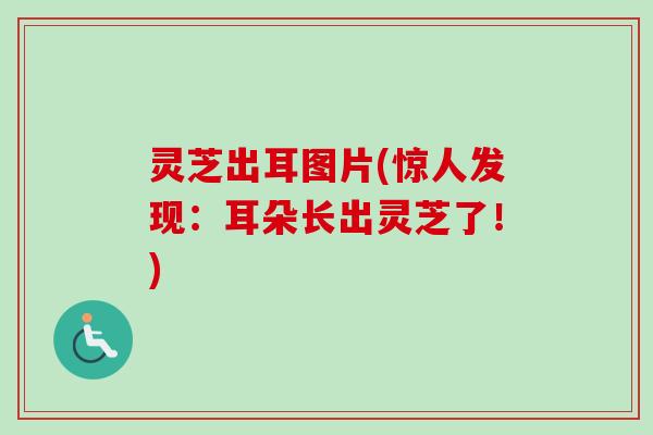 灵芝出耳图片(惊人发现:耳朵长出灵芝了!)-第1张图片-卓越灵芝孢子粉 灵芝出耳图片(惊人发现:耳朵长出灵芝了!)-第1张图片-卓越灵芝孢子粉