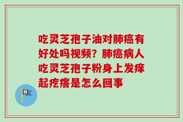 吃灵芝孢子油对肺癌有好处吗视频?肺癌病人吃灵芝孢子粉身上发痒起疙瘩是怎么回事-第1张图片-卓越灵芝孢子粉 吃灵芝孢子油对肺癌有好处吗视频?肺癌病人吃灵芝孢子粉身上发痒起疙瘩是怎么回事-第1张图片-卓越灵芝孢子粉