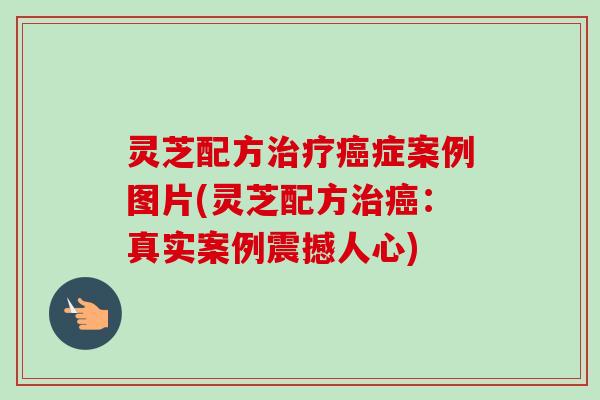 灵芝配方治疗癌症案例图片(灵芝配方治癌：真实案例震撼人心)-第1张图片-卓越灵芝孢子粉