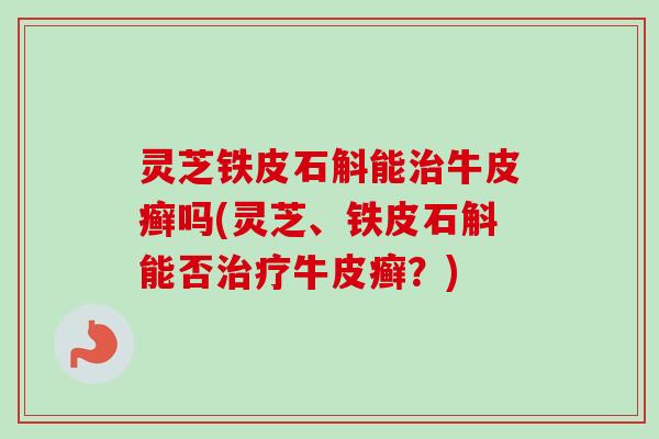 灵芝铁皮石斛能治牛皮癣吗(灵芝、铁皮石斛能否治疗牛皮癣？)-第1张图片-卓越灵芝孢子粉