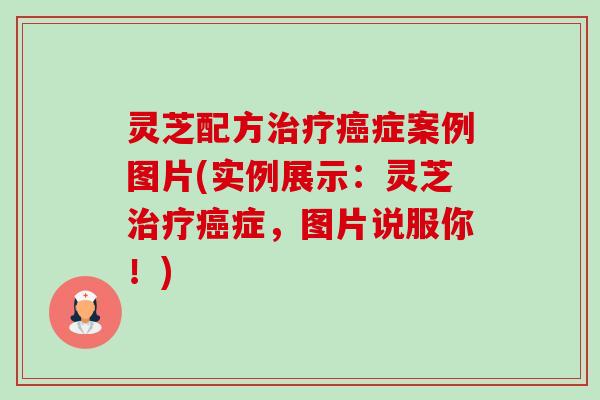 灵芝配方治疗癌症案例图片(实例展示:灵芝治疗癌症,图片说服你!)-第1张图片-卓越灵芝孢子粉 灵芝配方治疗癌症案例图片(实例展示:灵芝治疗癌症,图片说服你!)-第1张图片-卓越灵芝孢子粉