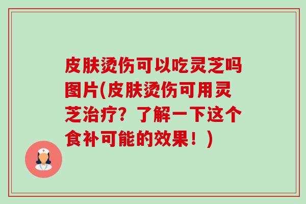 皮肤烫伤可以吃灵芝吗图片(皮肤烫伤可用灵芝治疗?了解一下这个食补可能的效果!)-第1张图片-卓越灵芝孢子粉 皮肤烫伤可以吃灵芝吗图片(皮肤烫伤可用灵芝治疗?了解一下这个食补可能的效果!)-第1张图片-卓越灵芝孢子粉