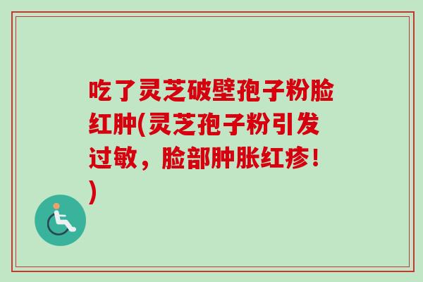 吃了灵芝破壁孢子粉脸红肿(灵芝孢子粉引发过敏,脸部肿胀红疹!)-第1张图片-卓越灵芝孢子粉 吃了灵芝破壁孢子粉脸红肿(灵芝孢子粉引发过敏,脸部肿胀红疹!)-第1张图片-卓越灵芝孢子粉