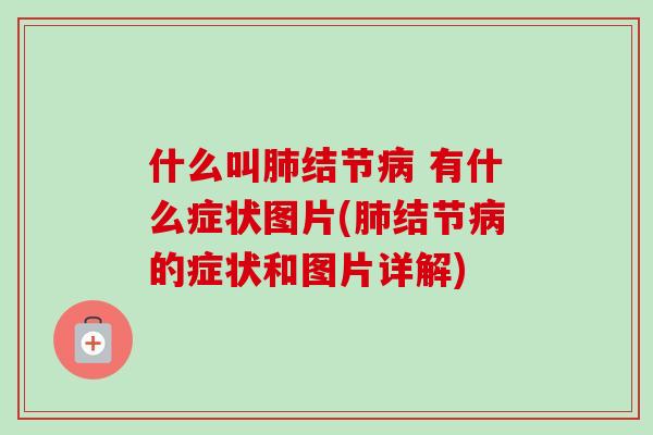 什么叫肺结节病 有什么症状图片(肺结节病的症状和图片详解)-第1张图片-卓越灵芝孢子粉 什么叫肺结节病 有什么症状图片(肺结节病的症状和图片详解)-第1张图片-卓越灵芝孢子粉