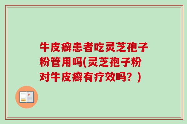 牛皮癣患者吃灵芝孢子粉管用吗(灵芝孢子粉对牛皮癣有疗效吗？)-第1张图片-卓越灵芝孢子粉